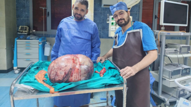 مستشفيات جامعة المنيا تنجح في استئصال ورم مبيضي نادر يزن 24 كيلوجرامًا